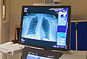 Radiology and Diagnostic Imaging - Fluoroscopy