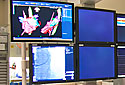 Interventional Procedures