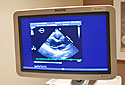 Echo Lab