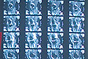Radiologist Reading Room